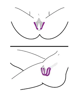 Oral Enhancing Labia Spreader
