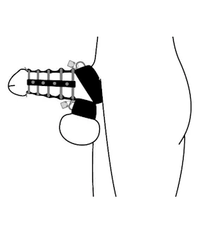 5 Ring Chasity Device