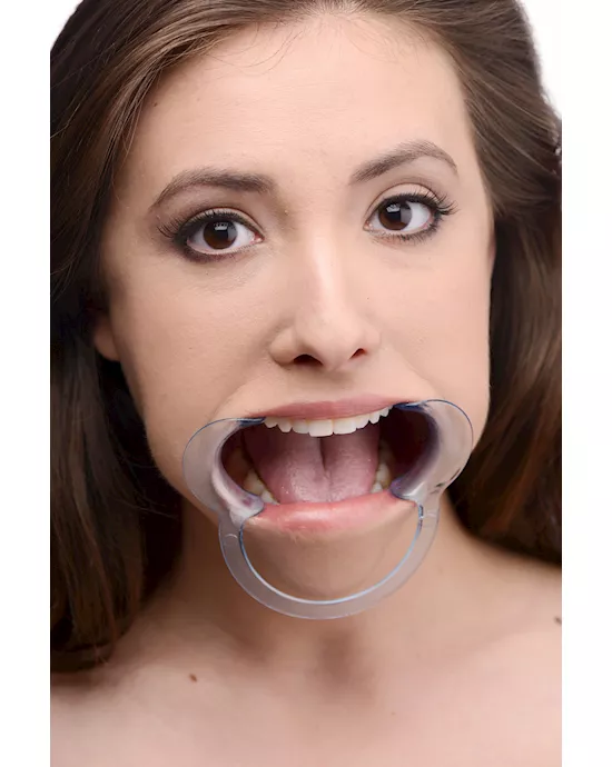 Cheek Retractor Dental Mouth Gag